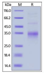 Mouse CD28, His Tag on SDS-PAGE under reducing (R) condition. The gel was stained overnight with Coomassie Blue. The purity of the protein is greater than 90%.